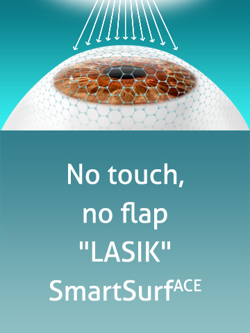 No touch, no flap 'LASIK' - SmartSurfACE